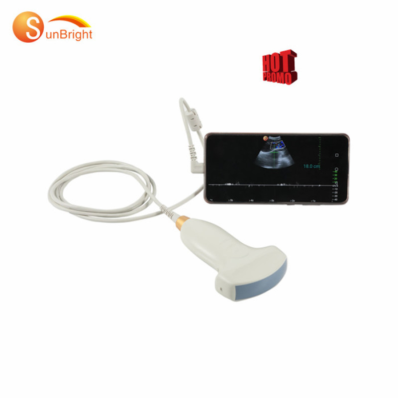 Sonda usb convexa wifi ultrasónica vascular portátil médica de alto rendimiento Sun P1