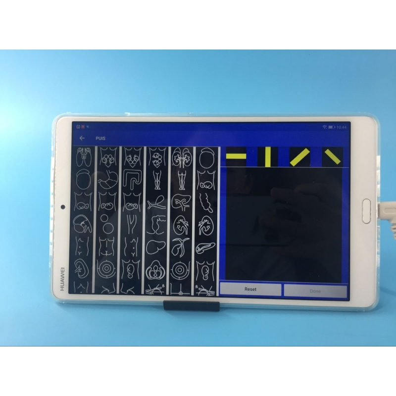 128 елементів Advanced USB Type C підключають ультразвуковий лінійний датчик високої чутливості