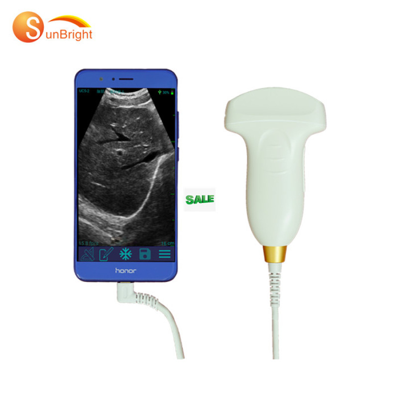 Medical Handheld Color Doppler USB Linear ultrasound scanner convex probe