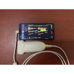 Windows and Android software screen usb ultrasound probe