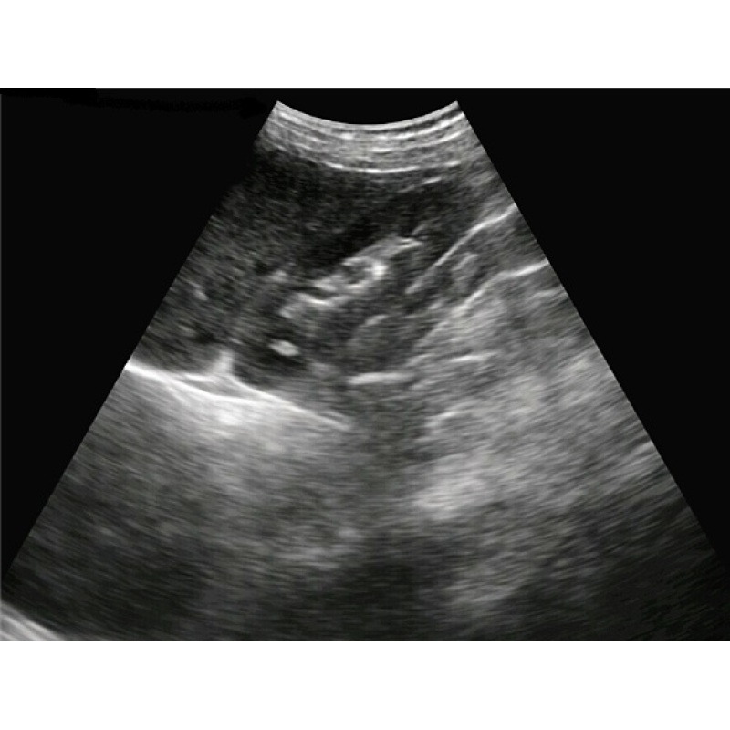 factory price high performance portable diagnostic usb probes ultrasound for sale