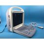 Biggest wireless ultrasound scanner color doppler ultrasound with linear probe
