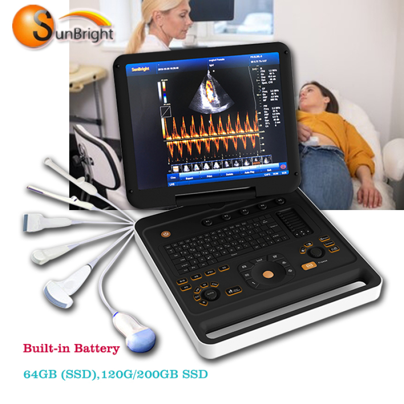 휴대용 초음파 기계 노트북 4D CW 하이 엔드 장비 시스템