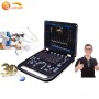 Medical doctor use home use personal sonogram machine doppler ultrasound