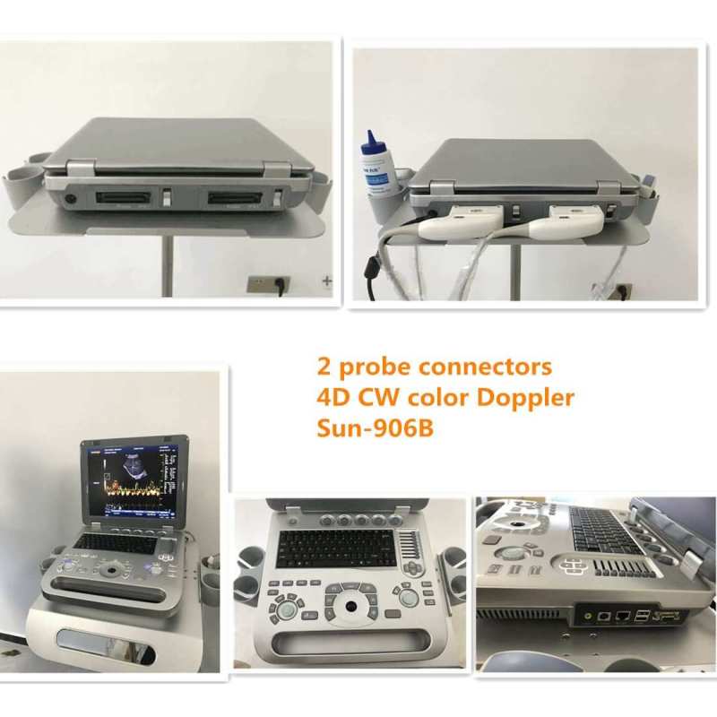 128 elements good quality color doppler ultrasound facotry sale 4D color doppler ultrasound instrument equipment