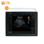 Human use ultrasound medical clinic machine fetal ultrasound human ultrasound machines