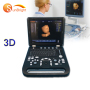 Hot sale portable 15 inch PC based Laptop 3D Ultrasound scanner machine