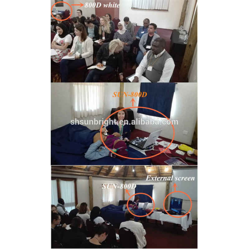 Real manufacturer portable b 3d ultrasound scanner machine cases machine