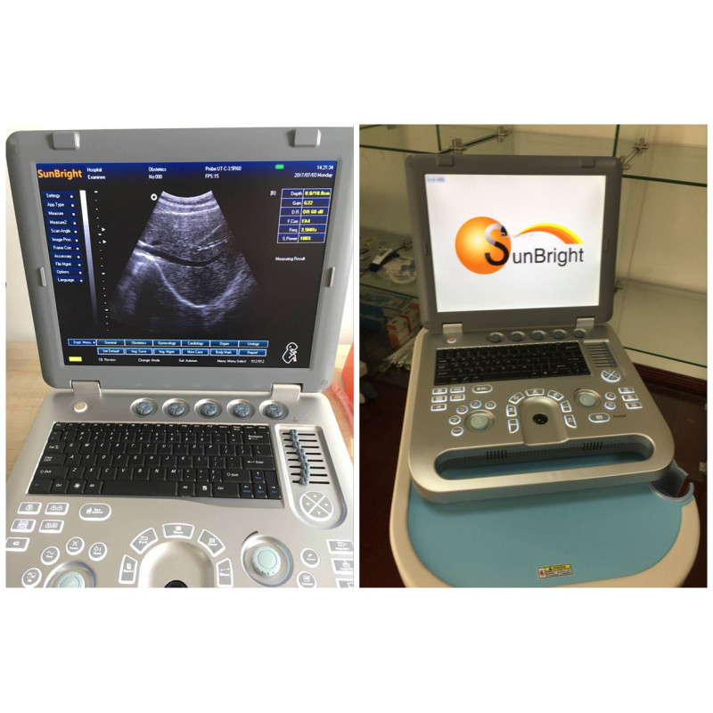 Obstetrics Gynecology Equipment 3D laptop ultrasound machine