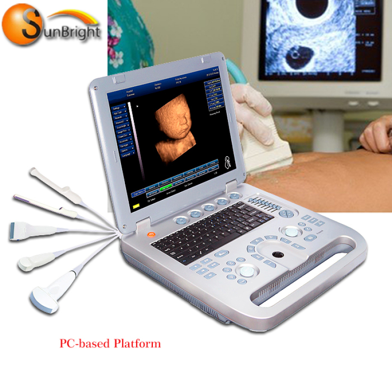 Real factory produce laptop ultrasound device 3D echo machine for big sale