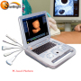 Real factory produce laptop ultrasound device 3D echo machine for big sale