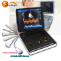 High Quality Trolley 3D/4D CW Color Doppler Ultrasound Machine