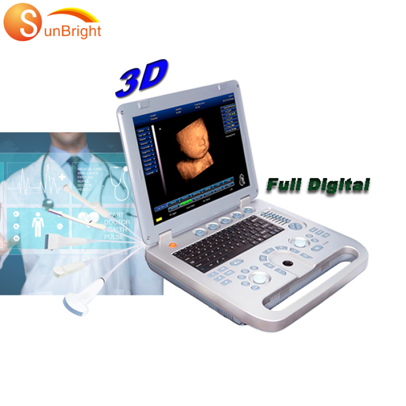 in home ultrasound machine Good clear image