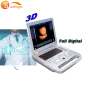 in home ultrasound machine Good clear image