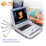 new upgraded high performance hospital ultrasound scanner trolley machine