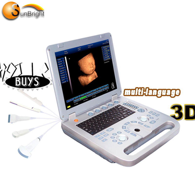 Echo price echographe high quality portable color sonography vascular ultrasound with linear probe