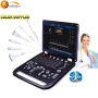 High resolution clear images portable cardiac 3D 4D color doppler ecografo portatil portable SUN-906A