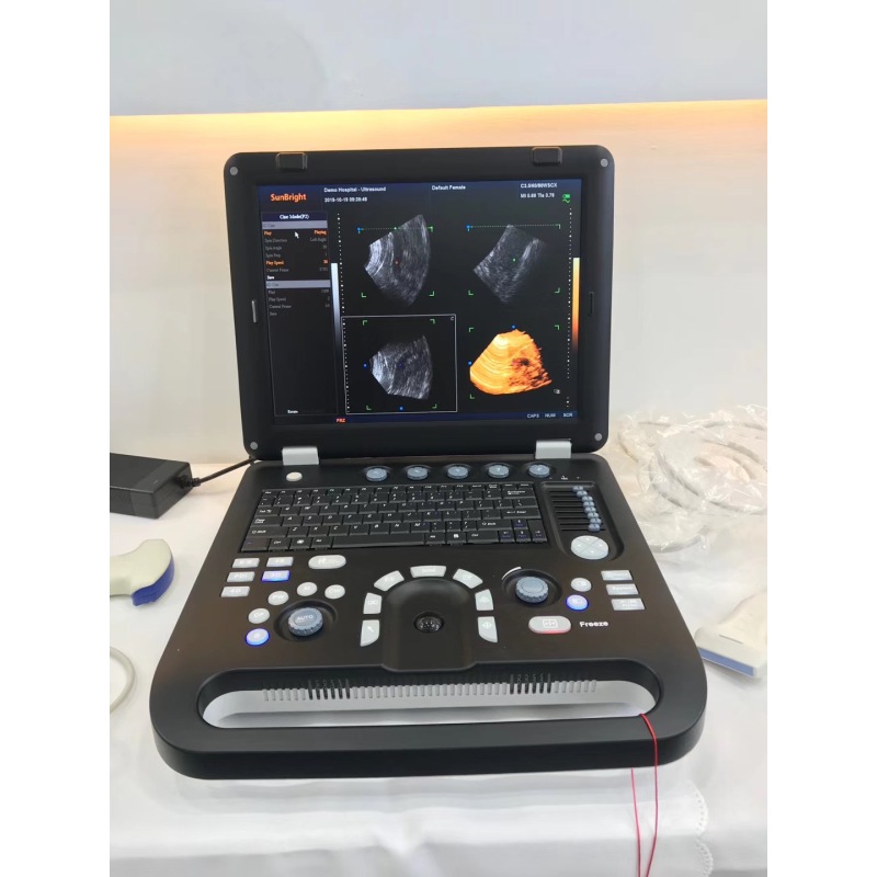 Portable 15 inch 3d 4d doppler ultrasound OB GYN color doppler imaging system