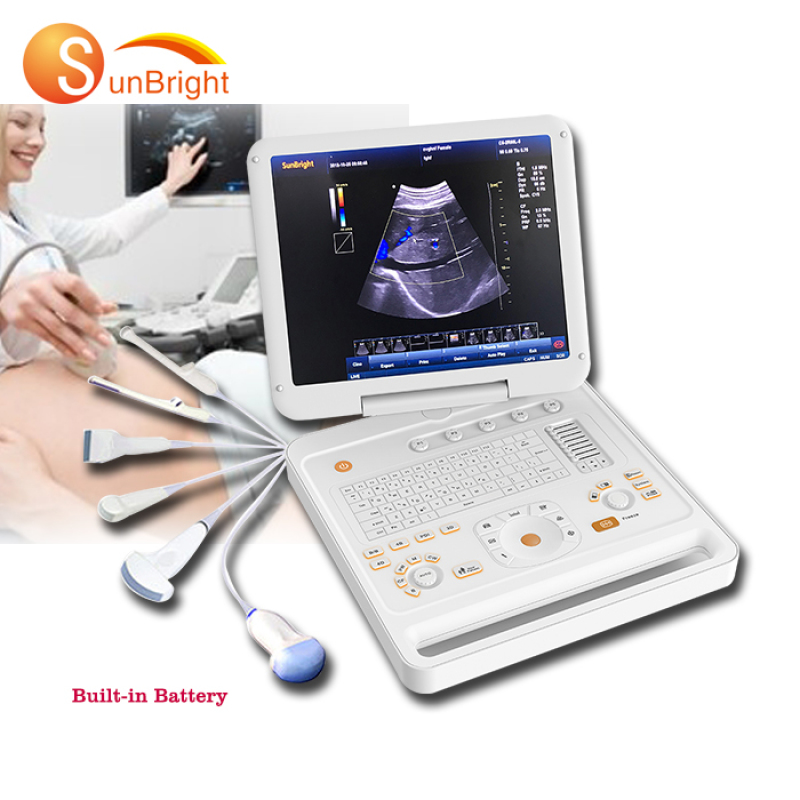 Obstetric 3D ultrasound machine price color Doppler low cost color Doppler scanner price
