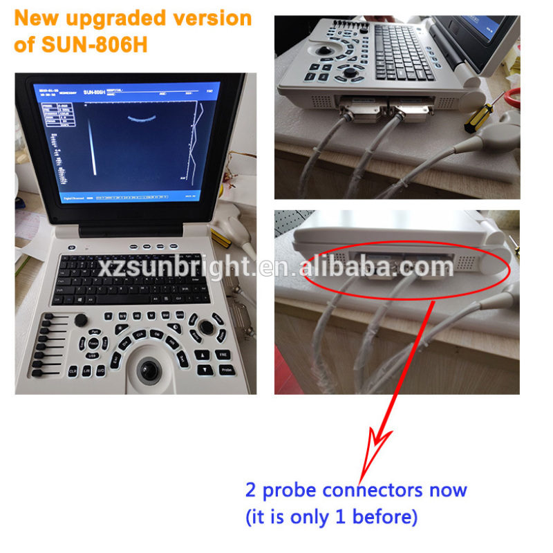 Medical Echocardiography 2D 3D image portable ultrasound device price