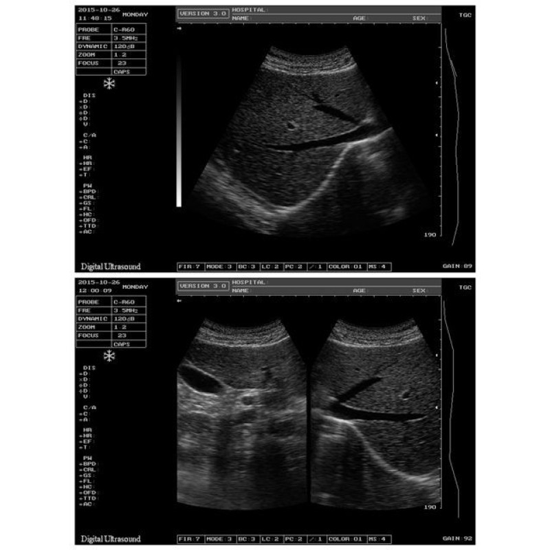 hot sale high intensity farm veterinary ultrasound operate easily hand small rectal ultrasound
