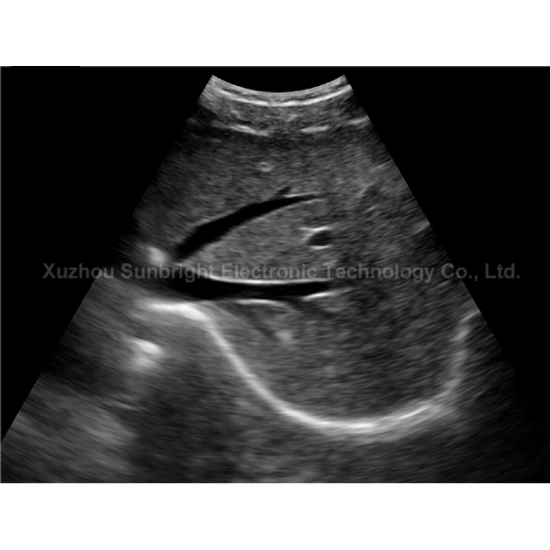 Echo Machine USB Ultrasound convex Probe Transducer ultrasound scanner USB convex probe