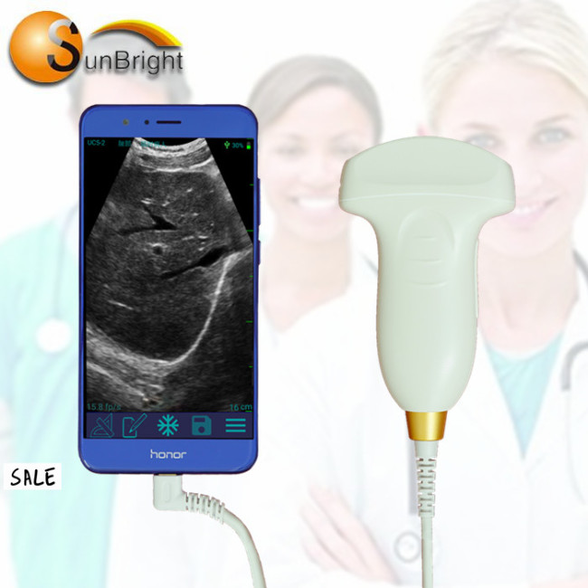 128 elements ultrasound probe USB convex probe for Windows Android diagnostic medical equipment