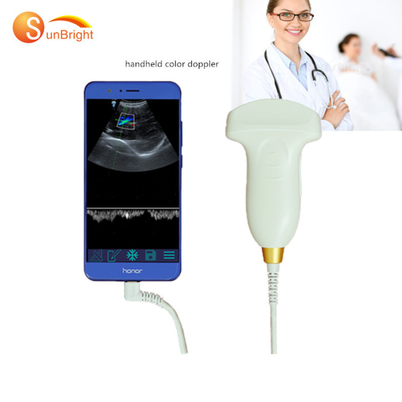 Hot sale Smart USB convex medical doppler ultrasound scanner mobile ultrasound probe