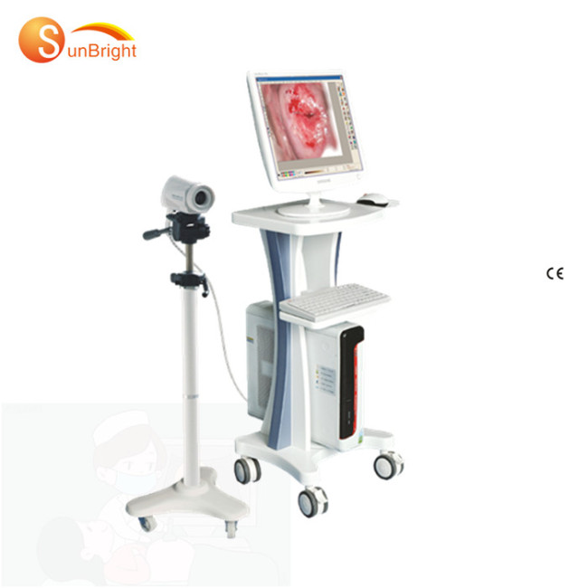colposcope price Medical gynecology equipment vagina diagnostic full digital colposcope