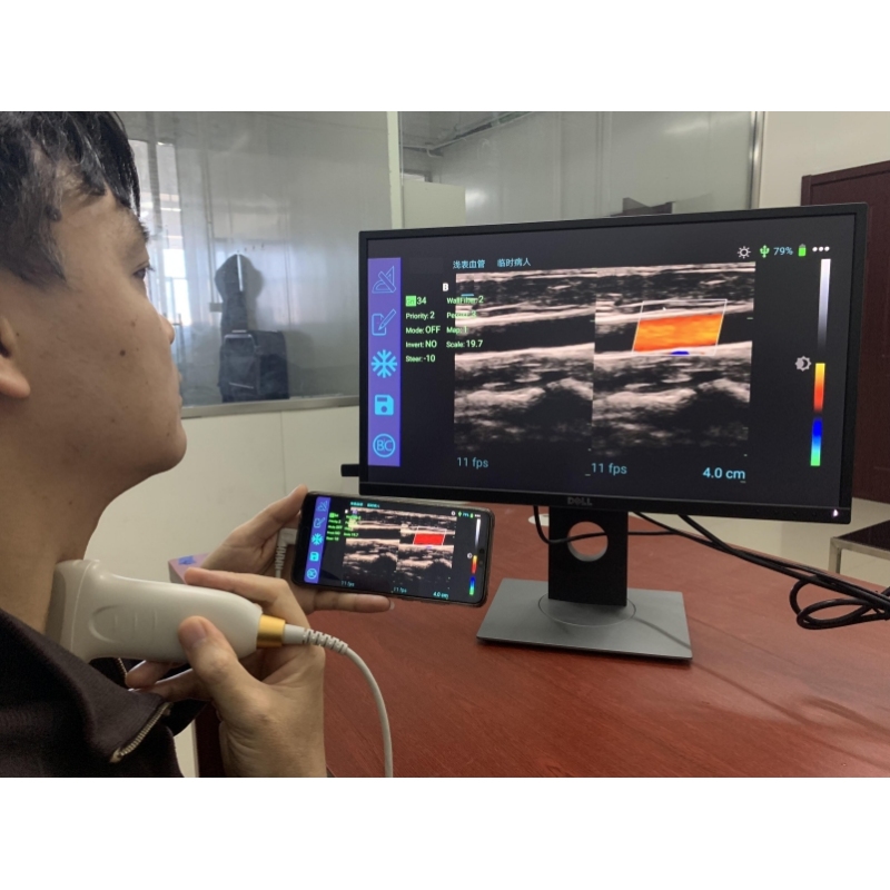 Hot sale medical portable USB port ultrasound linear probe with color doppler