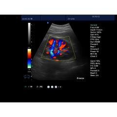 Vet lapyop ultrasound veterinary portable 2D color Doppler for pregnancy