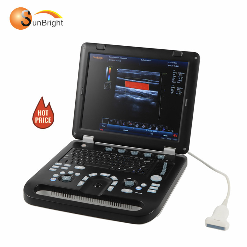 Portable Laptop 4D Color Doppler Ultrasound System Machine Factory Price