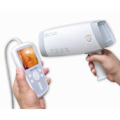 Cheapest Digital video camera colposcope Portable Handheld
