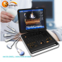 new ultrasound system laptop 4D CW color Doppler medical equipment