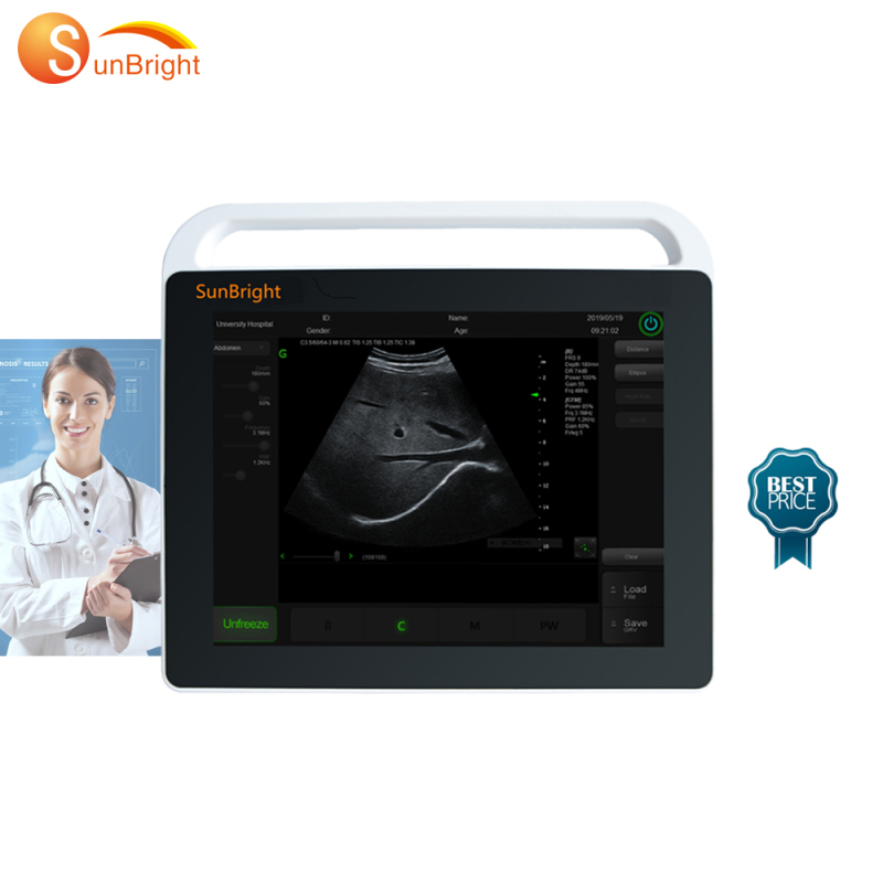 High working frequency touch screen vascular ultrasound machine