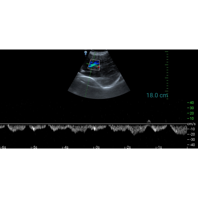bluetooth ultrasound Type C convex Doppler probe