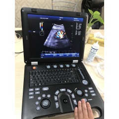Wireless full digital 128 elements 3D vet human therapeutic ultrasound scanner