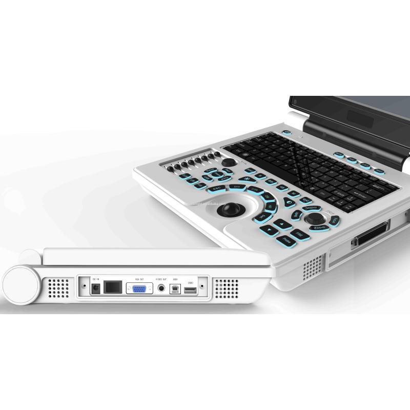 portable black and white laptop ultrasound with low price