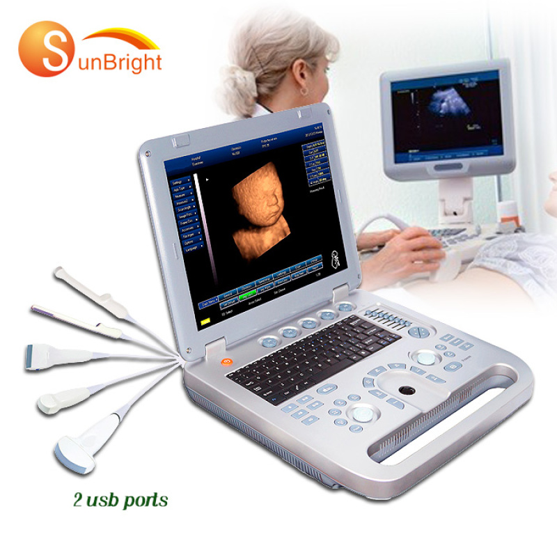 Medizinisches Ultraschallgerät zum besten Preis, effektiver Ultraschallscanner für Gynäkologie und Geburtshilfe