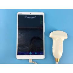 128 Elements wireless Wi-Fi ultrasound 3D USG Ultrasound Probe IOS Android Mobile Device