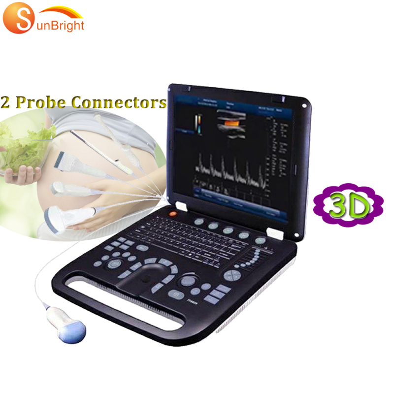 Volldigitales tragbares 3D-Scangerät, Arzt verwendet Farbultraschallgeräte