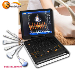 vascular doppler veterinary laptop medical high end CW hot selling machine