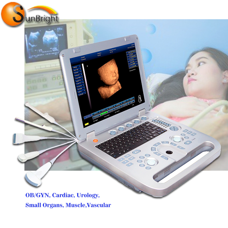 hot sale multi-function ultrasound machines for medical ultradiagnostic