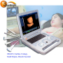 hot sale multi-function ultrasound machines for medical ultradiagnostic