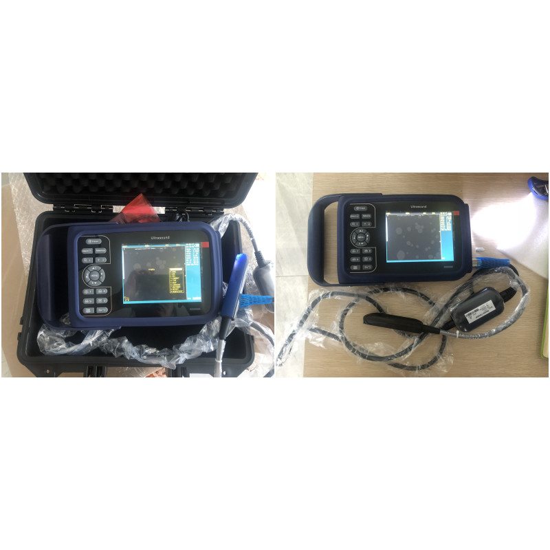 best veterinary ultrasound machine Cardiac Ultrasound Screen Hot Sale Ultrasound with 2 USB Ports