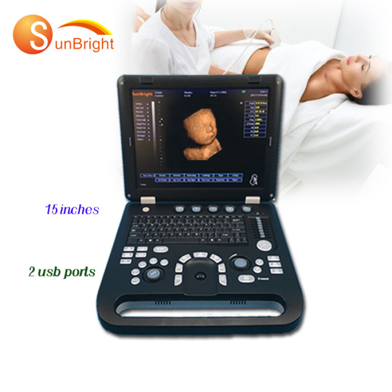 Hochleistungs-Sonographie, medizinischer PC-basierter Ultraschallscanner, Schwangerschaftstestgerät für Haustiere