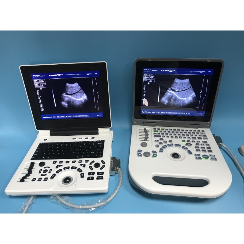 Macchina SUN-806G di scansione ad ultrasuoni per laptop con batteria a LED ad alte prestazioni