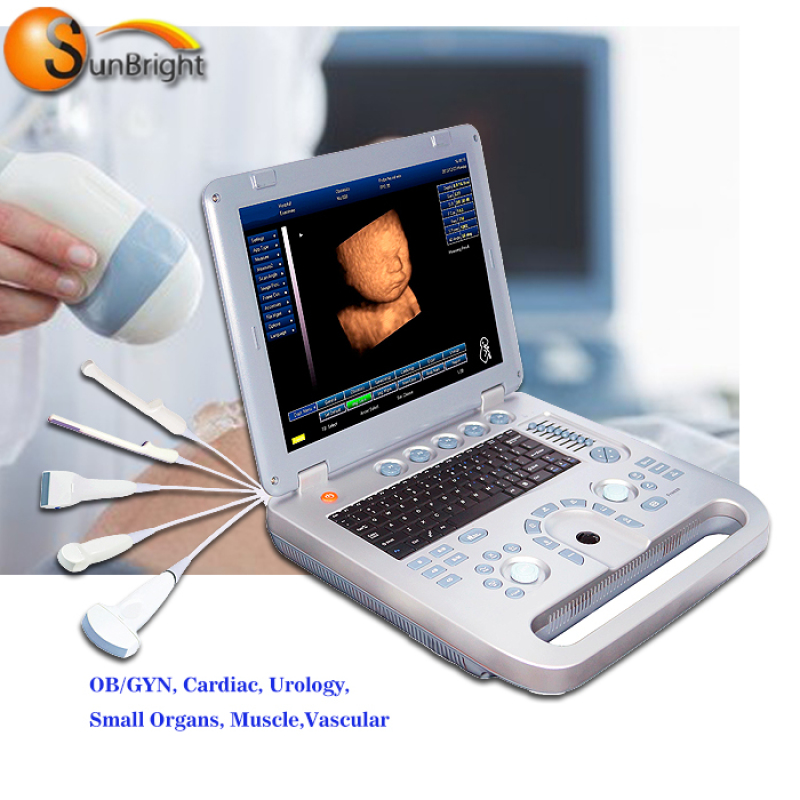 혈관 진단 동물용 저렴한 노트북 3D 이미지 에코 BW 초음파 고품질