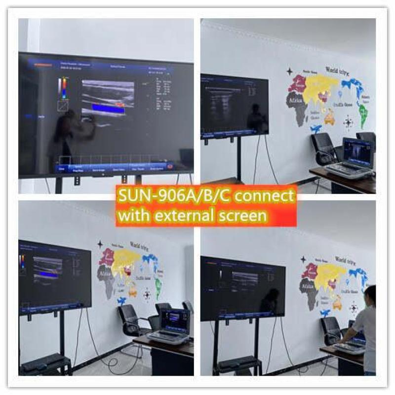 Portable 3D/4D CW Color Doppler price Digital Ultrasonic Diagnostic Machine