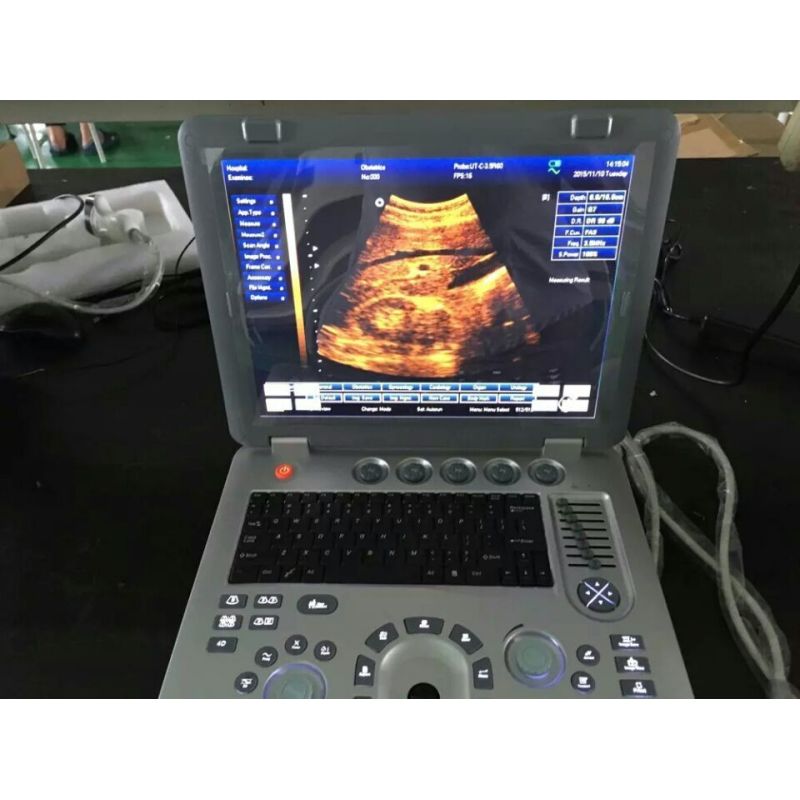 Real factory price 3D laptop transvaginal convex ultrasound pregnancy ultrasound